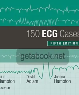 150 ECG cases by John Hampton-getabook.net