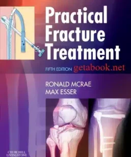 McRae Practical Fracture Treatment - 5th Edition - Ronald Mcrae