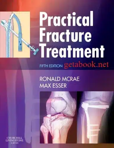 McRae Practical Fracture Treatment - 5th Edition - Ronald Mcrae