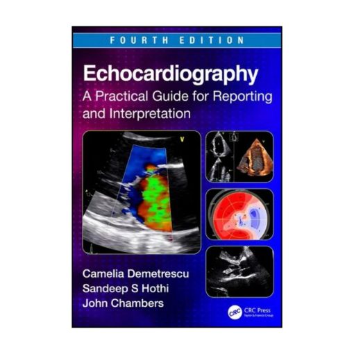 Echocardiography A Practical Guide