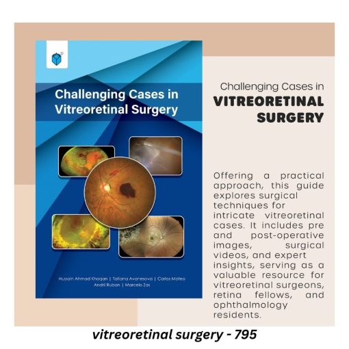 Challenging Cases in Vitreoretinal Surgery