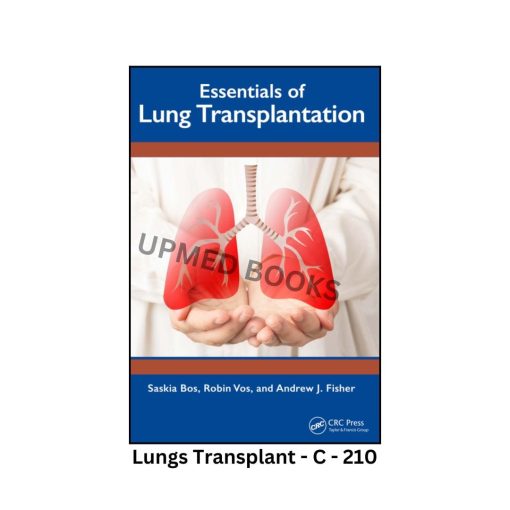 Essentials of Lung Transplantation