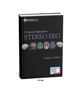 A Practical Approach to STEREO EEG