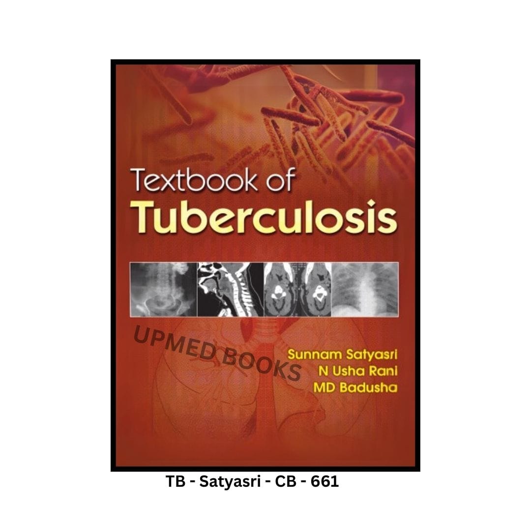 Textbook of Tuberculosis