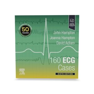 160 ECG Cases