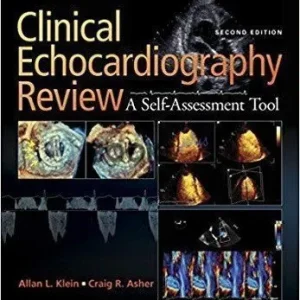 Clinical Echocardiography 2nd Edition