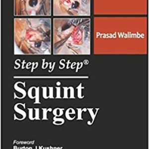 Step by Step Squint Surgery