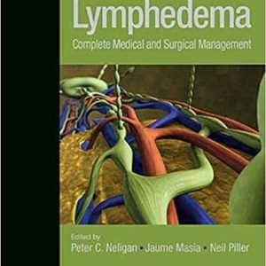 Lymphedema Complete Medical and Surgical Management