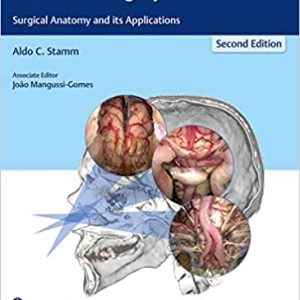 Transnasal Endoscopic Skull Base and Brain Surgery Surgical Anatomy and its Applications 2nd Ed