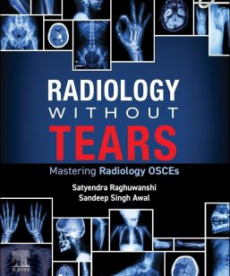 Radiology Without Tears: Mastering Radiology OSCEs