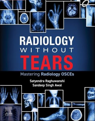 Radiology Without Tears: Mastering Radiology OSCEs