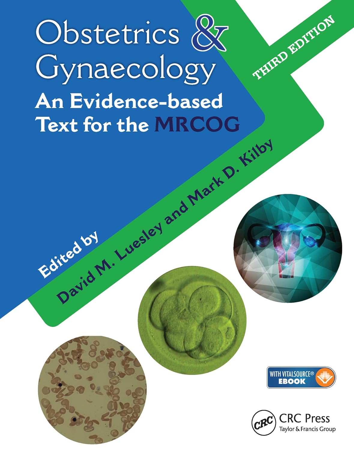 EBM Obstetrics and Gynaecology for MRCOG: An Evidence-Based Text for MRCOG