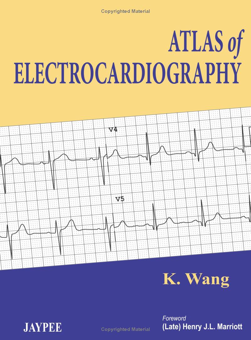 Atlas of Electrocardiography by K Wang