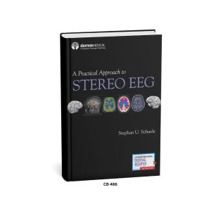 A Practical Approach to STEREO EEG