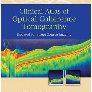 CLINICAL ATLAS OF OPTICAL COHERENCE TOMOGRAPHY: UPDATED FOR SWEPT SOURCE IMAGING