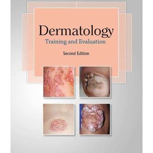 DERMATOLOGY TRAINING & EVALUTION 2ND EDITION