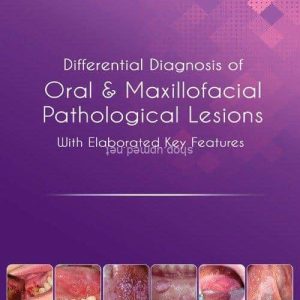 Differential Diagnosis and Key Features of Oral & Maxillofacial Pathological Lesions by Sadia Minhas