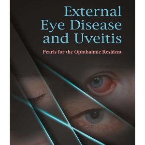 EXTERNAL EYE DISEASE AND UVEITIS: PEARLS FOR THE OPHTHALMIC RESIDENT