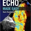 Echo Made Easy