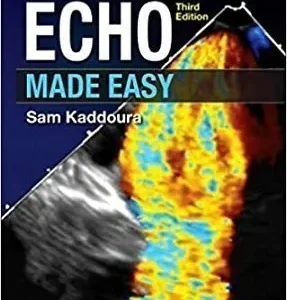 Echo Made Easy
