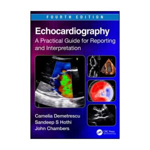 Echocardiography: A Practical Guide for Reporting and Interpretation