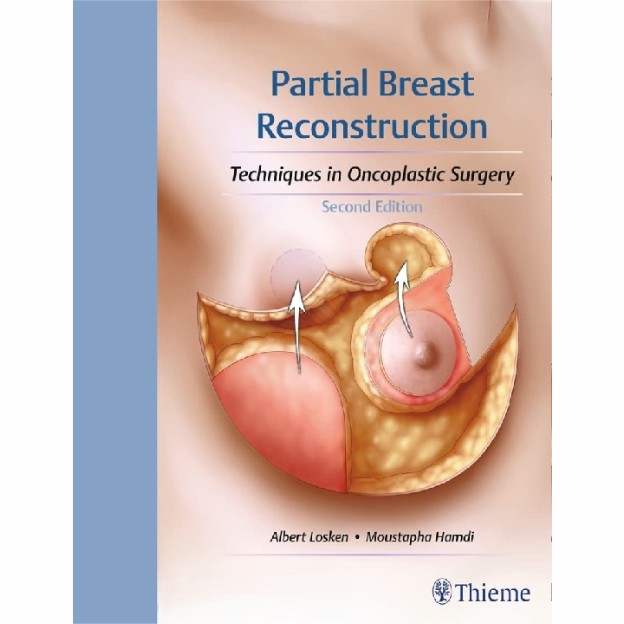 Partial Breast Reconstruction: Techniques in Oncoplastic Surgery