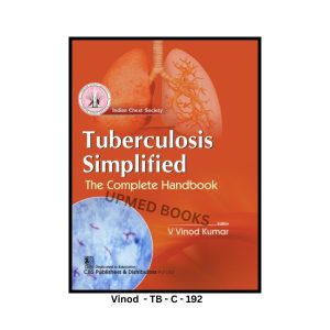 Tuberculosis Simplified: The Complete Handbook