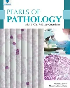 Pearls of Pathology with MCQs and East Questions